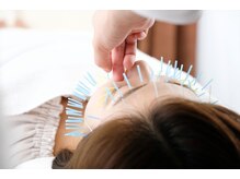 銀のすず 銀座院/美容鍼×幹細胞