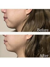 リタ(Rita.)/顎下スッキリ！