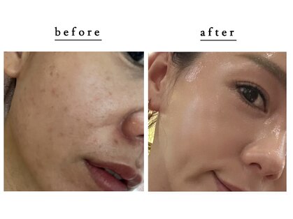 ロータス(LOTUS)の写真