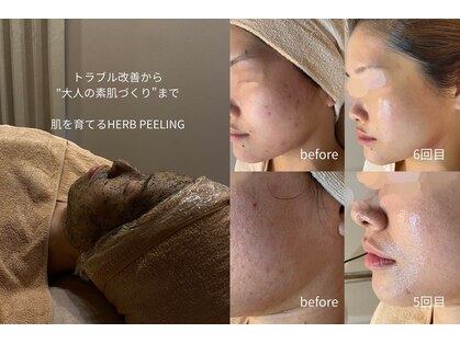 ルーヴェ(Luve)の写真