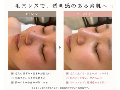 ポーラ リサ 南船場店(POLA R-isa)の写真
