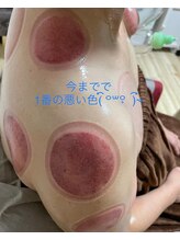 リラク笑美(reraku笑美)/気になるメニュー！！