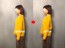 アトラス/初回のお客様のBefore＆after