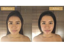 グレースフィオーレ 那覇店(gracefiore)/☆ビフォーアフター１２☆