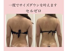ビューティー アディクト(Beauty addict)の雰囲気（強力痩身マシン【セルゼロ】導入！5アタックでぜい肉を撃退☆）
