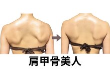 ニュートラル 池袋店(NEUTRAL)/施術結果【痩身/冷え性/肩こり】