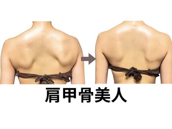 ニュートラル 池袋店(NEUTRAL)/施術結果【痩身/冷え性/肩こり】
