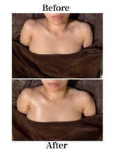 ハリムーン 仙台(harimoon)/120分美バストビフォーアフター