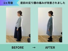 トミーリハ整体院(TOMMY REHA整体院)/産前の腰痛改善