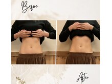 第二の脳といわれる腸に、優しく暖かく触れる腸もみでスッキリ！