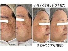 クリニカルホワイトケア 豊見城店(クリニカルWHITEケア)の雰囲気（3ヶ月で厚塗り卒業！コンシーラーいらずの素肌を叶えます。）