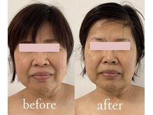 トリートメントルーム フェリーチェ(Felice)/重心上向き、左右差と傾き調整