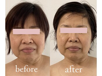 トリートメントルーム フェリーチェ(Felice)/重心上向き、左右差と傾き調整