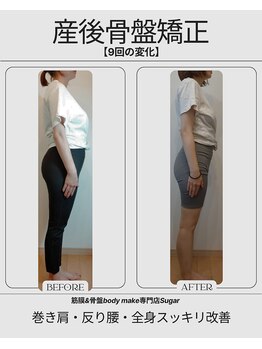 シュガー 津市(Sugar)/BeforeAfter【産後骨盤矯正】
