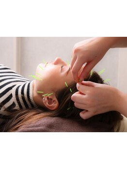 鍼灸施術を受けたい