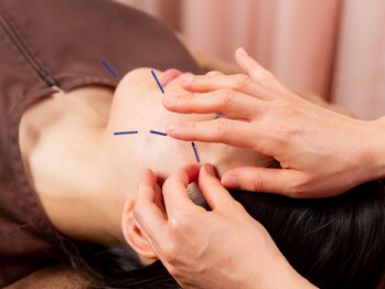 長野鍼灸治療院/話題の美容鍼!これで美肌◎