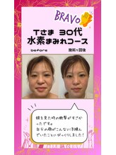 ヨサパーク リユ(YOSA PARK Riyu)/驚きの変化 Vo.1