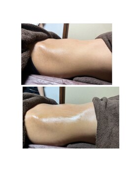 アール(R)/テスラセラピー1回の効果！