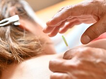 鈴木鍼灸院 天王寺 阿倍野の雰囲気（痛みや辛さの根本改善をテーマに鍼灸施術を行っています。）