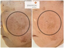 サラシック(salachic)の雰囲気（【エンビロン】高濃度ビタミン導入肌トラブル改善メニュー多数）