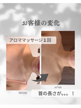 ココフルール(Cocofleur)/お手入れ1回・ホームケア1点