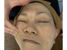 ドリームフェイス 岡山倉敷本店の雰囲気（【つる肌】繰り返すニキビ悩みに効果大！毛穴/皮脂汚れ/黒ずみ◎）