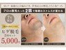 【毎月50名様以上が利用★】お得なヒゲ脱毛2回セット【効果実感の声多数】