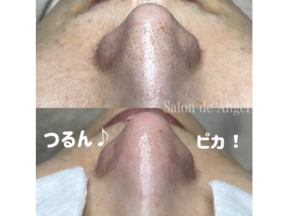 サロン ド エンジェル(Salon de Angel)の写真