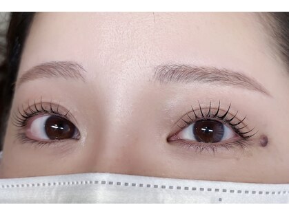 ミューズアイ(muse eye)の写真