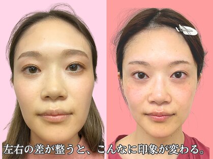 ナチュラルビューティーフェイス 横浜(NBF)の写真