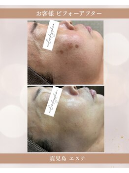 ミーラブ 鹿児島(miilove)/