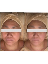 ラキア 五位堂駅前店(Ra kia)/シミケア