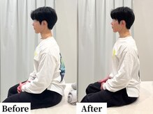 ソレア(Solea)/背中の張り・肩こり改善１回目