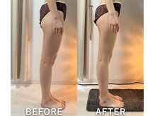 リュミエール(Lumiere)/ヒップライン変化