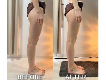 リュミエール(Lumiere)/ヒップライン変化