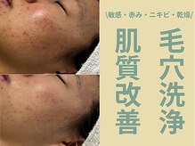 サンラックスサロン 岐阜(SANlux Salon)