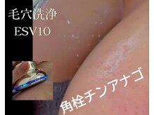 プレジール(Plaisir)の雰囲気（最新★吸引しない！毛穴洗浄ESV１０！同時に艶＆リフトアップ）
