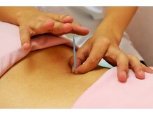 笹塚さくら鍼灸整骨院/はり・きゅうもおすすめ