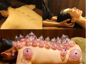 モミーズ(momii's)/プチ鍼付きカッピング