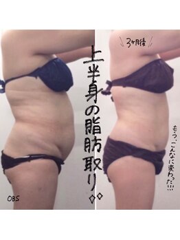 OBS新潟整骨院/５０代でも変われます♪