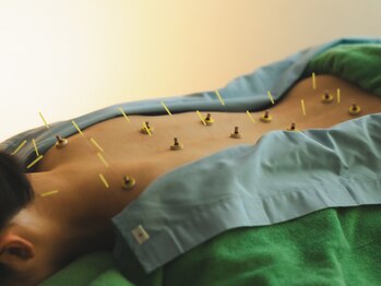 ボディーキュア アオイ(Body cure Aoi)/肩こりや頭痛、めまい感の解消