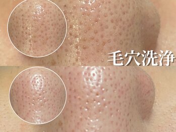 アイブロウサロン アヴィ(A‘VI)/小鼻毛穴洗浄