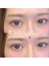 ボス(VOSS)/マツパ