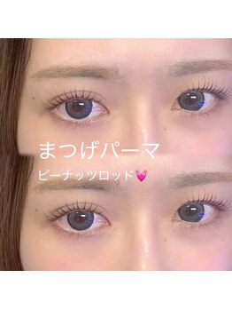 ボス(VOSS)/マツパ