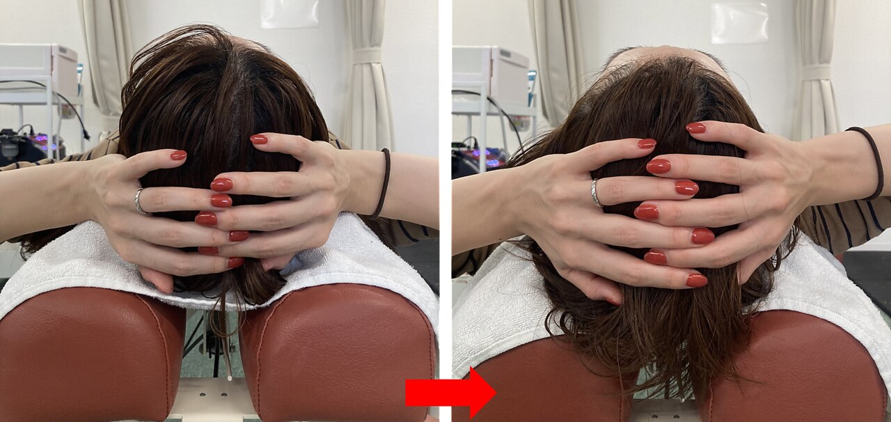 豊中市でクラニオパシー・頭蓋骨矯正がおすすめのサロン