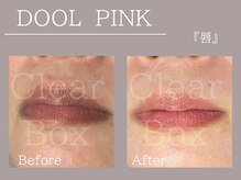 クリアボックス(Clear box)/【DOOL PINK】モニター様募集中