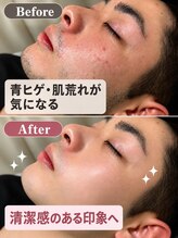 アルゴ 熊本玉名店(ALGO)&nbsp;ビフォー アフター