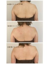 シトロン(citron)/バストケア