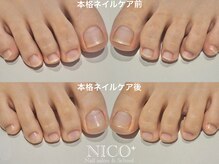 ニコプラス(NICO+)/爪育ネイルケア
