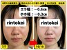 【5月先行予約可能】小顔特化美容鍼16500円3ヶ月集中コース初回体験60分→